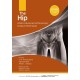 The Hip: AANA Advanced Arthroscopic Surgical Techniques