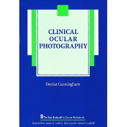 Clinical Ocular Photography