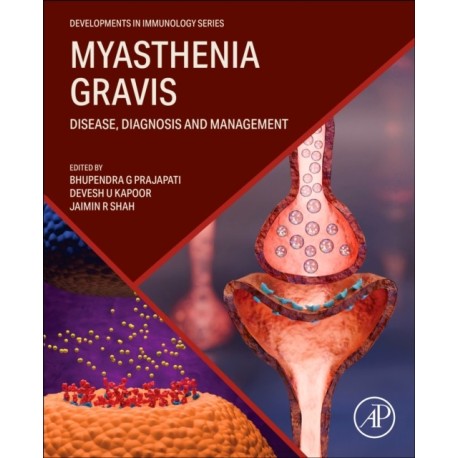 Myasthenia Gravis: Disease, Diagnosis and Management
