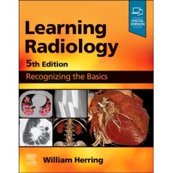 Learning Radiology: Recognizing the Basics