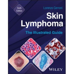 Skin Lymphoma: The Illustrated Guide
