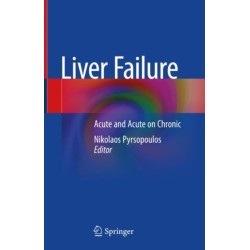 Liver Failure: Acute  and Acute on Chronic