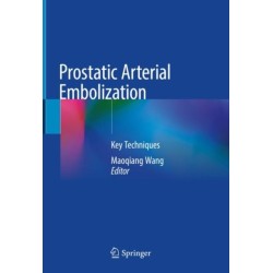 Prostatic Arterial Embolization: Key Techniques