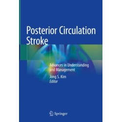 Posterior Circulation Stroke: Advances in Understanding and Management