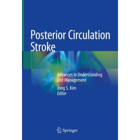 Posterior Circulation Stroke: Advances in Understanding and Management