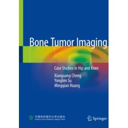 Bone Tumor Imaging: Case Studies in Hip and Knee