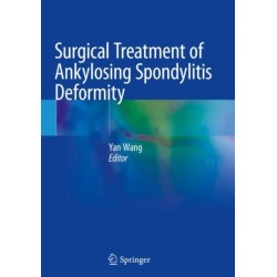 Surgical Treatment of Ankylosing Spondylitis Deformity