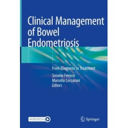 Clinical Management of Bowel Endometriosis: From Diagnosis to Treatment
