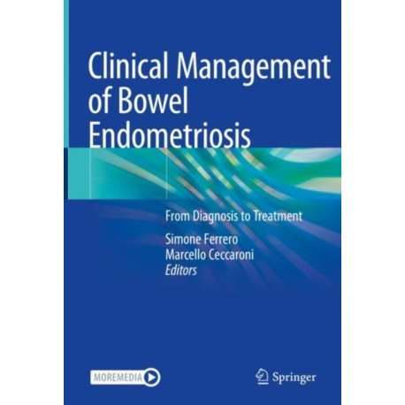 Clinical Management of Bowel Endometriosis: From Diagnosis to Treatment