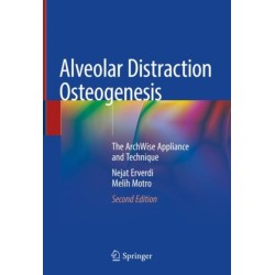 Alveolar Distraction Osteogenesis: The ArchWise Appliance and Technique