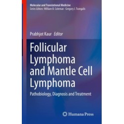 Follicular Lymphoma and Mantle Cell Lymphoma: Pathobiology, Diagnosis and Treatment