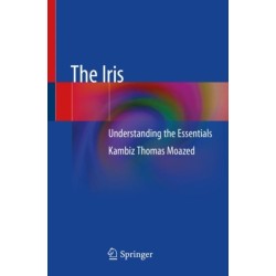 The Iris: Understanding the Essentials