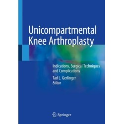 Unicompartmental Knee Arthroplasty: Indications, Surgical Techniques and Complications