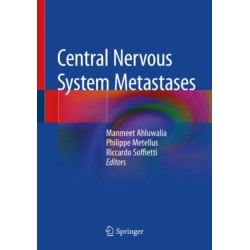 Central Nervous System Metastases