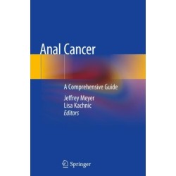 Anal Cancer: A Comprehensive Guide