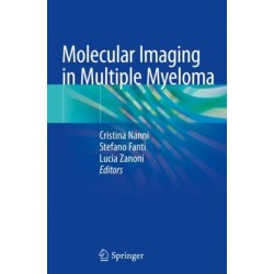 Molecular Imaging in Multiple Myeloma