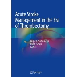 Acute Stroke Management in the Era of Thrombectomy