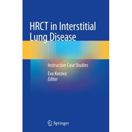 HRCT in Interstitial Lung Disease: Instructive Case Studies