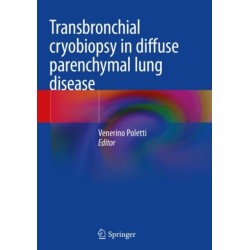 Transbronchial cryobiopsy in diffuse parenchymal lung disease
