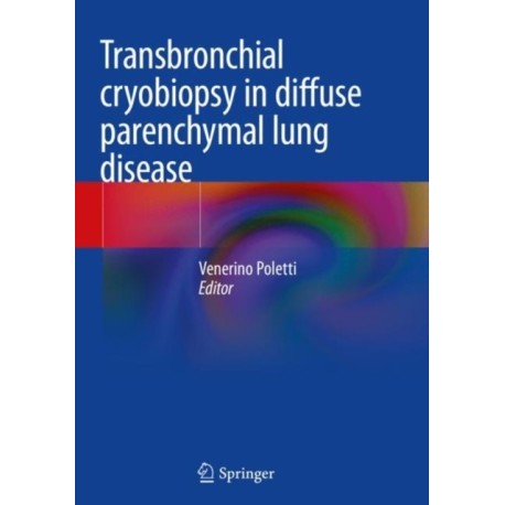 Transbronchial cryobiopsy in diffuse parenchymal lung disease