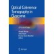 Optical Coherence Tomography in Glaucoma: A Practical Guide