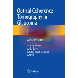 Optical Coherence Tomography in Glaucoma: A Practical Guide