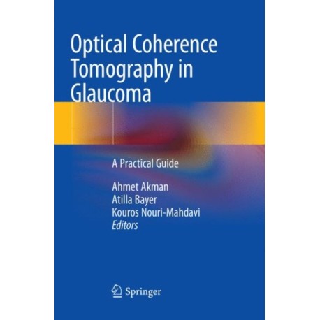 Optical Coherence Tomography in Glaucoma: A Practical Guide
