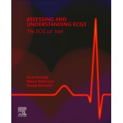Assessing and Understanding ECGs: The ECG10+ tool
