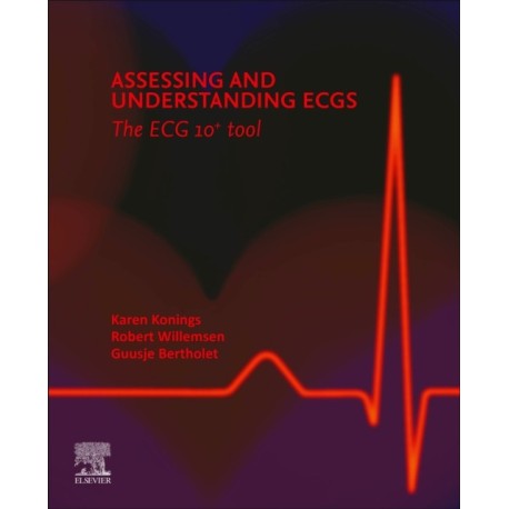 Assessing and Understanding ECGs: The ECG10+ tool