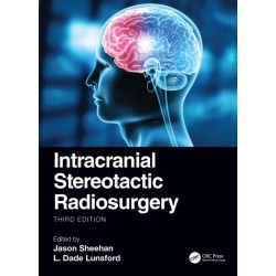 Intracranial Stereotactic Radiosurgery