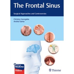 The Frontal Sinus: Surgical Approaches and Controversies