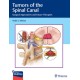 Tumors of the Spinal Canal: Surgical Approaches and Future Therapies