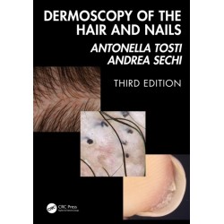 Dermoscopy of the Hair and Nails 3e