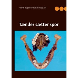Tænder sætter spor