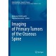 Imaging of Primary Tumors of the Osseous Spine