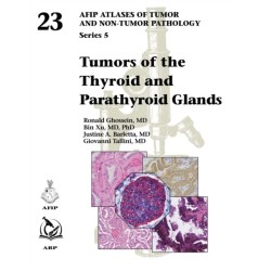 Tumors of the Thyroid and Parathyroid Glands