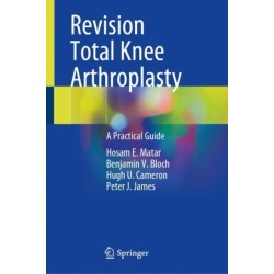 Revision Total Knee Arthroplasty: A Practical Guide