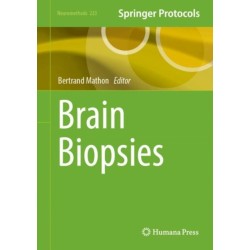 Brain Biopsies