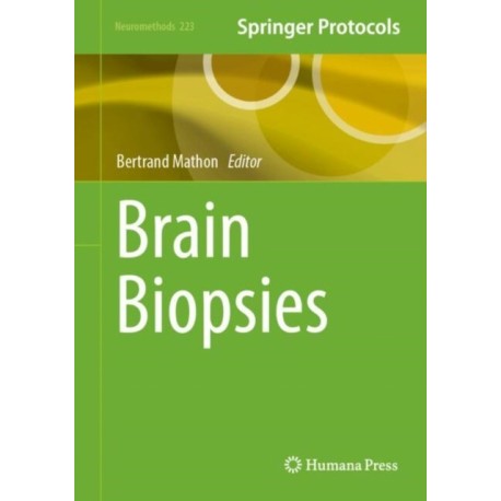 Brain Biopsies