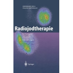 Radiojodtherapie: Bei Benignen Und Malignen Schilddra1/4senerkrankungen