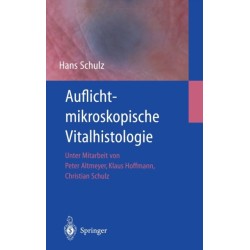 Auflichtmikroskopische Vitalhistologie: Dermatologischer Leitfaden