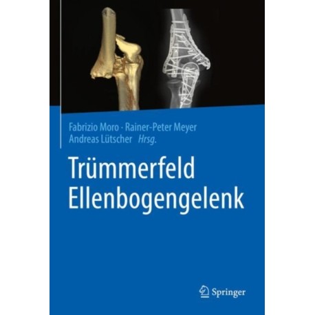 Trummerfeld Ellenbogengelenk