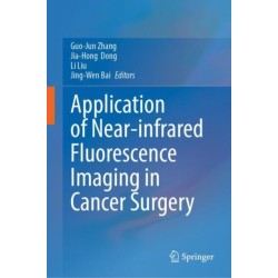 Application of Near-infrared Fluorescence Imaging in Cancer Surgery