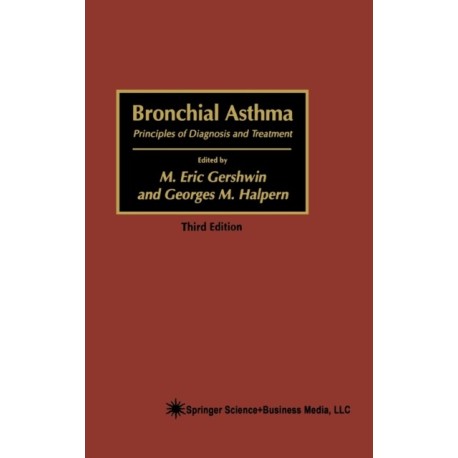 Bronchial Asthma: Principles of Diagnosis and Treatment