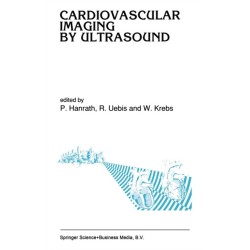 Cardiovascular Imaging by Ultrasound