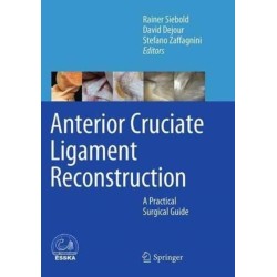 Anterior Cruciate Ligament Reconstruction: A Practical Surgical Guide