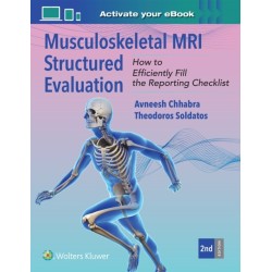 Musculoskeletal MRI Structured Evaluation: How to Efficiently Fill in the Reporting Checklist