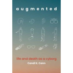 augmented: life and death as a cyborg