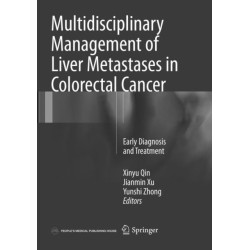 Multidisciplinary Management of Liver Metastases in Colorectal Cancer: Early Diagnosis and Treatment