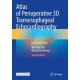 Atlas of Perioperative 3D Transesophageal Echocardiography: Cases and Videos